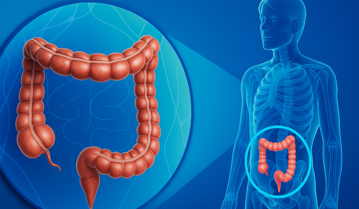 Colorectal Cancer vs IBS