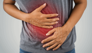 Colorectal Cancer vs IBS