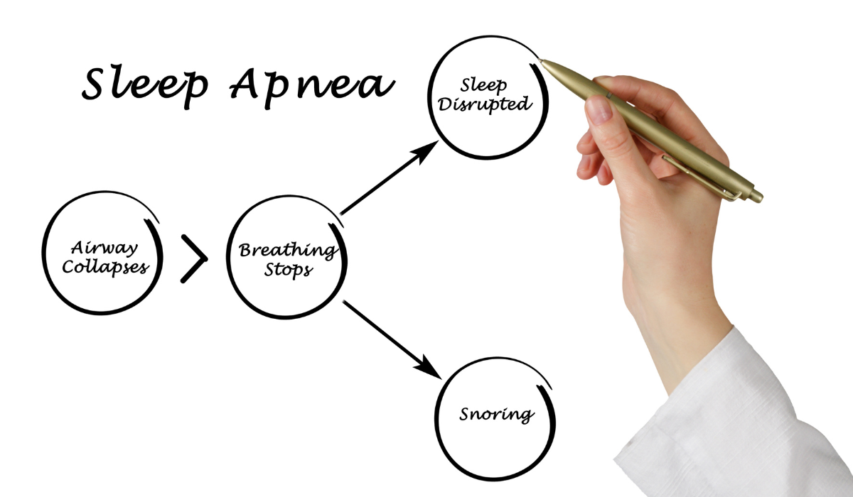 Risk of sleep apnea 