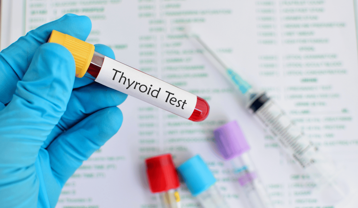 Treatment Options for Hyperthyroidism