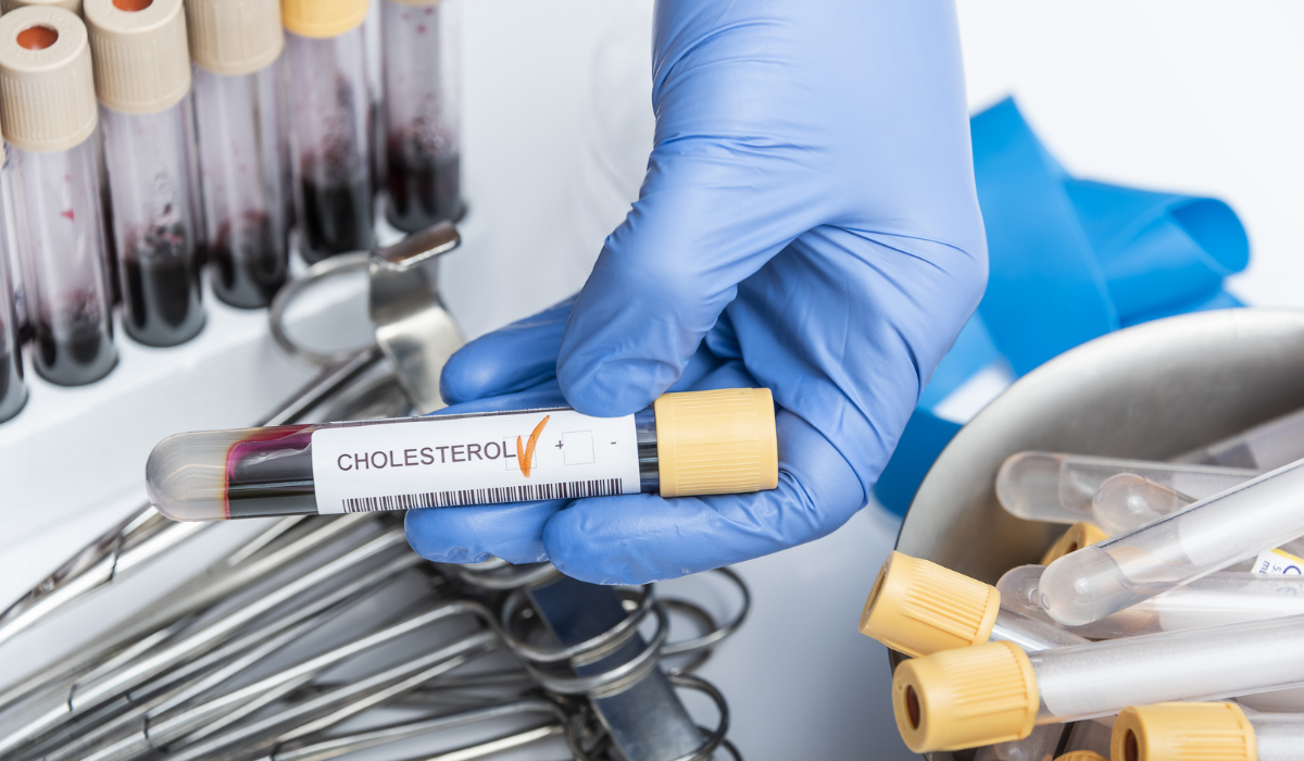 High cholesterol medication